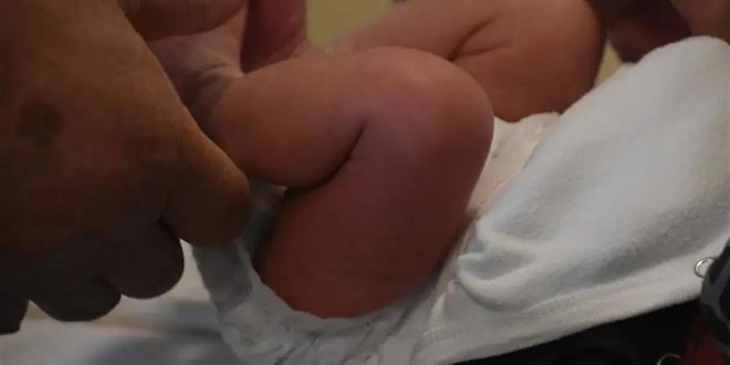 S�nnet edilen 27 g�nl�k bebek �ld�! Doktora soru�turma a��ld�