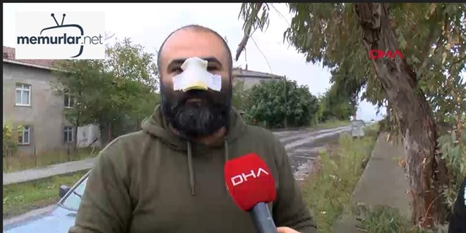 Tasmas�z dola�t�r�lan pitbull, i� insan�n�n burnunu kopard�