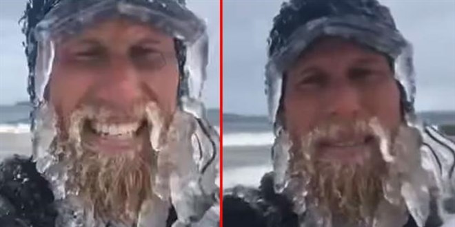 Saniyeler i�erisinde sakallar� dondu!