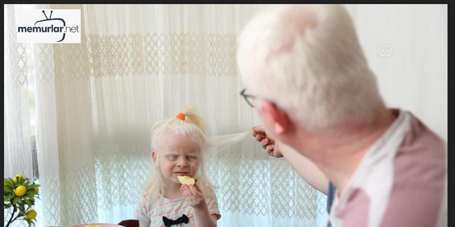 ��retmen ve m�ezzin �ift kendileri gibi iki �ocuklar�yla albinizmlilere �rnek oluyor -1-